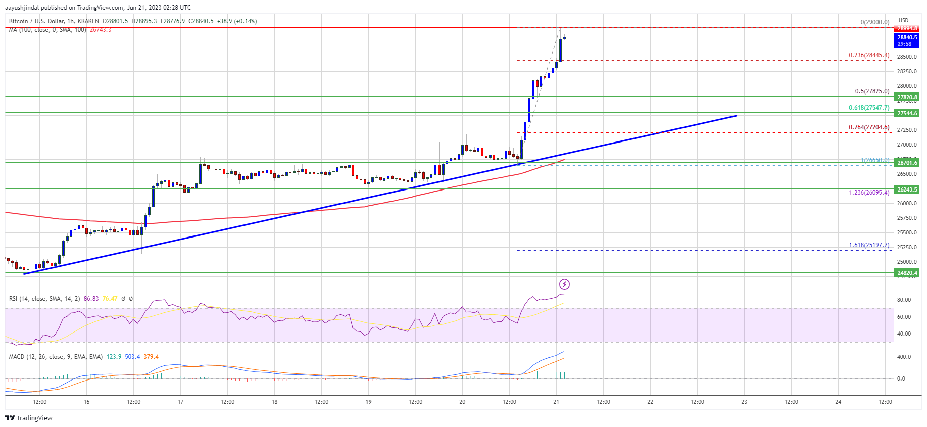 Bitcoin Price